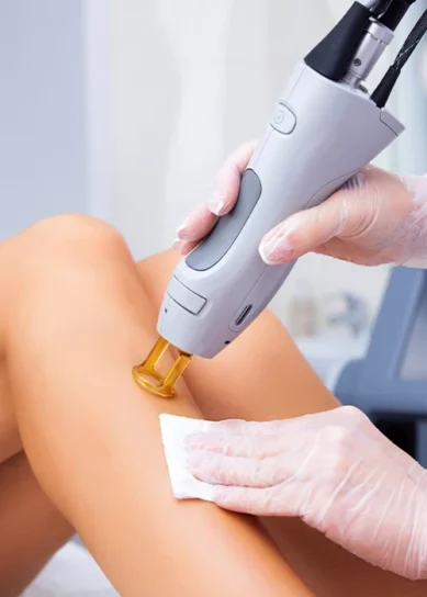 trattamenti laser epilazione alessandrite macchie tatuaggi capillari giulia tadiotto cicogna dermatologo dermatologa medicina estetica laser padova treviso conegliano vittorio veneto